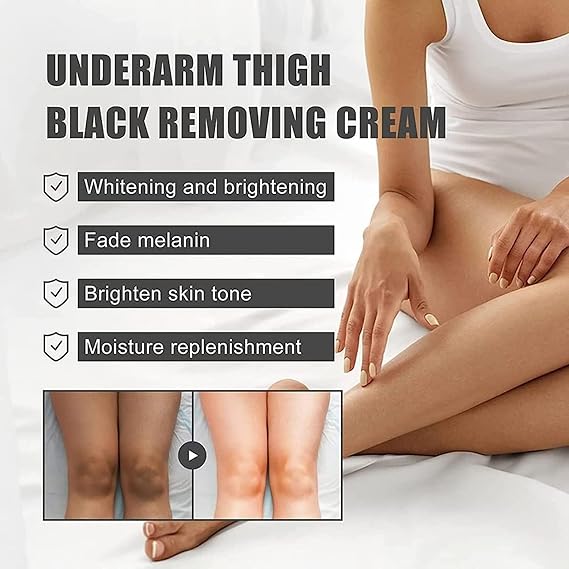 LAST DAY OF DISCOUNT š„ Dark Spot Remover Cream (30ml)
