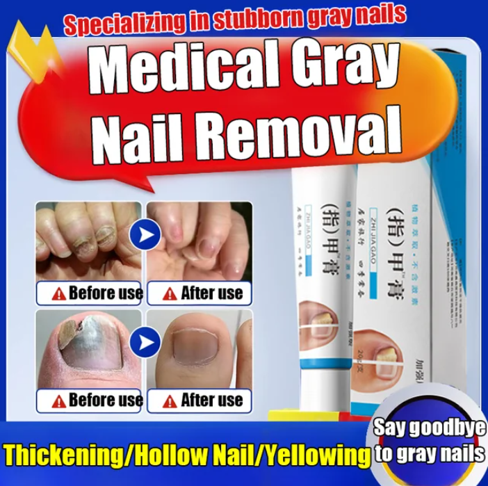LAST DAY OF DISCOUNT 🔥 Fungal Nail Treatment Cream
