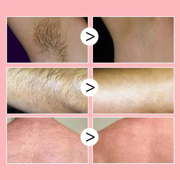 Last Day Of Discount 🔥 Hair Remover Spray