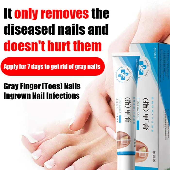 LAST DAY OF DISCOUNT 🔥 Fungal Nail Treatment Cream