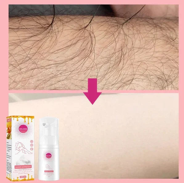 Last Day Of Discount 🔥 Hair Remover Spray