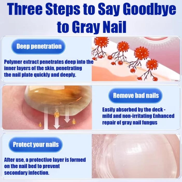 LAST DAY OF DISCOUNT 🔥 Fungal Nail Treatment Cream