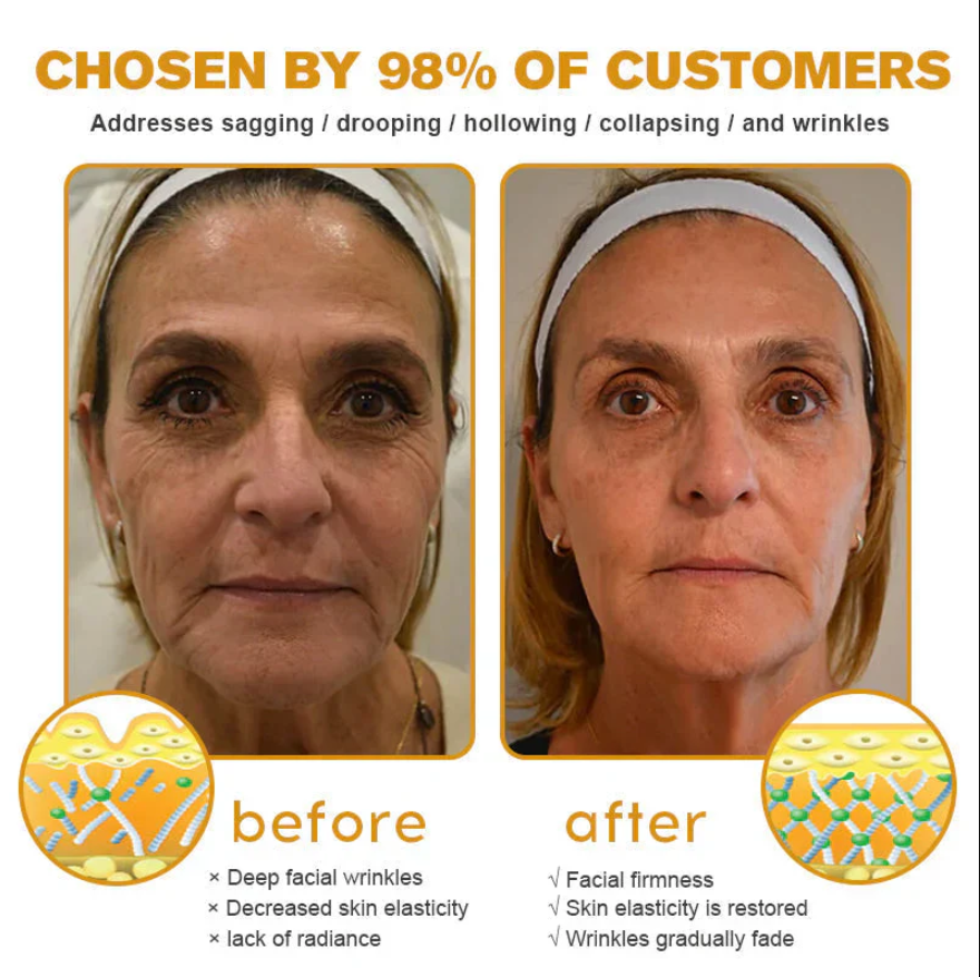 Last Day Of Discount 🔥 Bee Venom Wrinkle Removal Cream