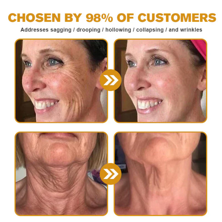Last Day Of Discount 🔥 Bee Venom Wrinkle Removal Cream