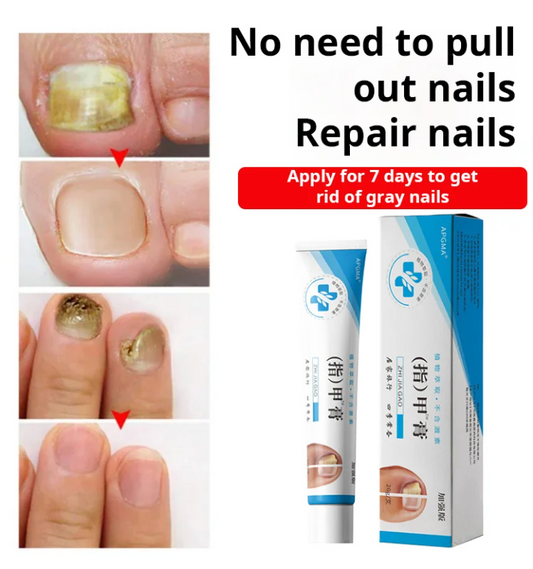 LAST DAY OF DISCOUNT 🔥 Fungal Nail Treatment Cream